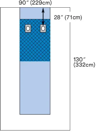 3M Steri-Drape Cardiovascular Drape Femoral Angiography Drape 90 W X 130 L Inch Sterile – 1191