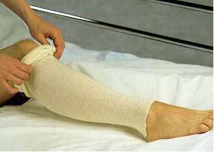 Alba Healthcare Albahealth Stockinette Tubular AlbaHealth 3 Inch X 25 Yard Cotton NonSterile – 81320