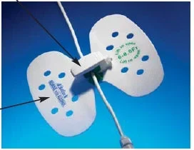 Bard StatLock Stabilization Device – VUPD1214