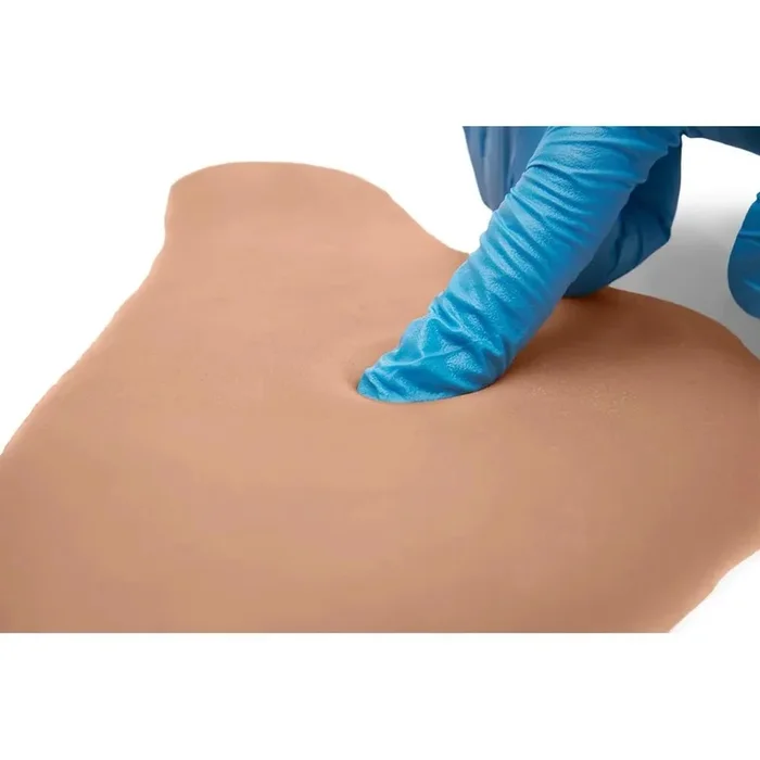 CAE Medicor Pitting Edema Sticky Pads 6 PC Mix Package