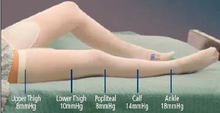 Cardinal T.E.D. Anti-embolism Stockings Thigh High X-Large / Regular – 3181LF