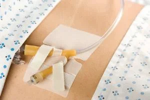 Cath-Secure Dual Tab Tube Holder, Hypoallergenic 3″ by MC Johnson Co Inc