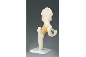 Dynatronics Skeleton Hip Right Joint Model Life Size – ARM81