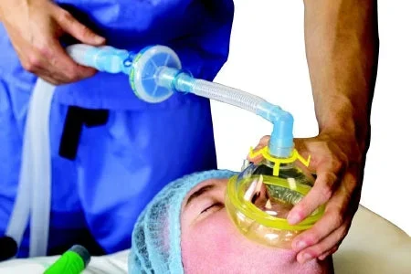 Flexicare Flexicare Anesthesia Breathing Circuit Corrugated Tube 72 Inch Tube Pediatric 1 Liter Bag Disposable – 038-02-602U