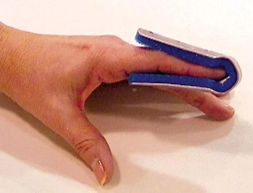 Fold Over Finger Splint Medium Bulk PK/6 Non-Retail