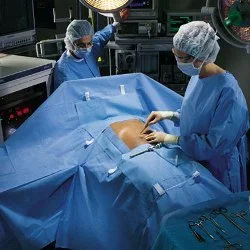 O&M Halyard Inc Abdominal Drape Laparoscopic / Abdominal Drape 100 W X 76 W X 124 L Inch Sterile – 89233