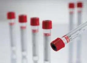Vacuette Z Serum Sep Clot Venous Blood Collection Tube