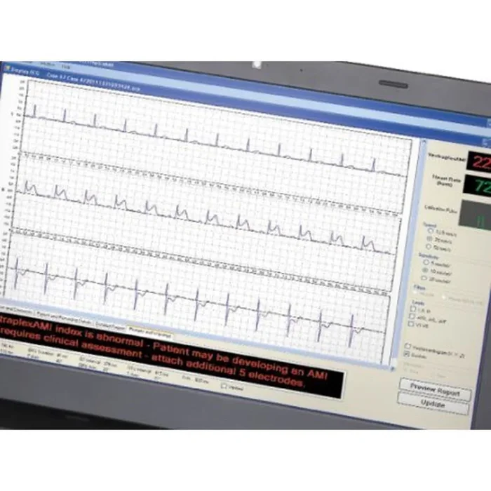 Vectracor Vectraplex ECG