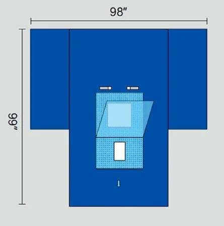 Welmed Protect5 Abdominal Drape Laparoscopy T-Drape 98 W X 99 L Inch Sterile – 1222-2190